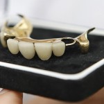 article-dentures-420x0